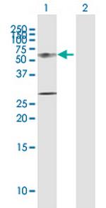 KRT12 Polyclonal Antibody, MaxPab™