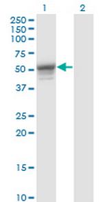 KRT13 Antibody in Western Blot (WB)