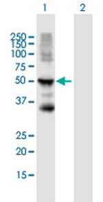 KRT15 Antibody in Western Blot (WB)