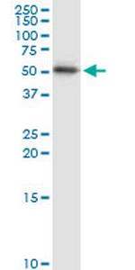 KRT15 Antibody in Western Blot (WB)