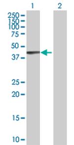 KRT17 Antibody in Western Blot (WB)