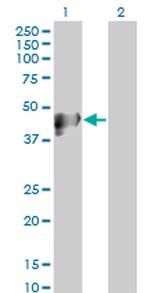 KRT17 Antibody in Western Blot (WB)