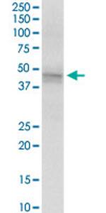 KRT18 Antibody in Western Blot (WB)