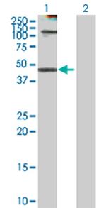 KRT18 Antibody in Western Blot (WB)