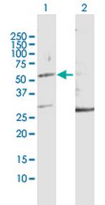 KRT32 Antibody in Western Blot (WB)