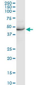 KRT35 Polyclonal Antibody, MaxPab™