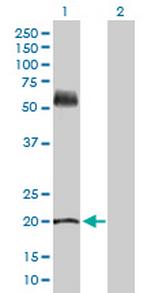 KRT81 Polyclonal Antibody, MaxPab™