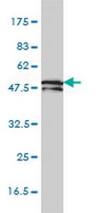 KRTHB1 Monoclonal Antibody (3B10-5B10)