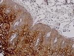 KRT81 Antibody in Immunohistochemistry (Paraffin) (IHC (P))