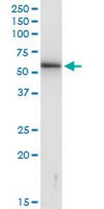 KRTHB3 Polyclonal Antibody, MaxPab™