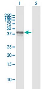 LAG3 Antibody in Western Blot (WB)