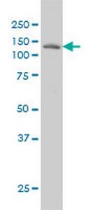 LAMB3 Monoclonal Antibody (2G10)