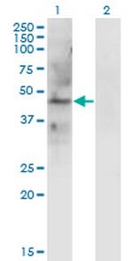 LAMP2 Monoclonal Antibody (2G10)