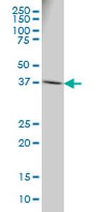 RPSA Antibody in Western Blot (WB)