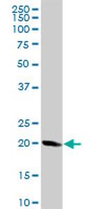 STMN1 Antibody in Western Blot (WB)