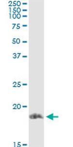 STMN1 Antibody in Immunoprecipitation (IP)
