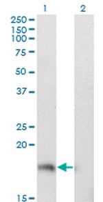 STMN1 Antibody in Western Blot (WB)
