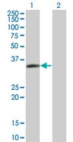 LASP1 Monoclonal Antibody (4F5)