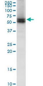 LBR Polyclonal Antibody, MaxPab™