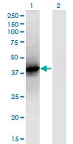 LCAT Monoclonal Antibody (4A9)