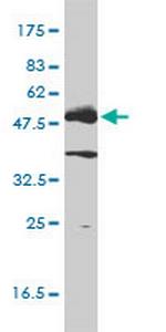 LCK Monoclonal Antibody (3F7-F5)