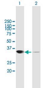 LDHA Polyclonal Antibody, MaxPab™