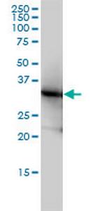 LDHB Monoclonal Antibody (2H6)