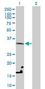 LDHC Polyclonal Antibody, MaxPab™
