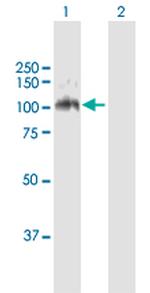 LDLR Antibody in Western Blot (WB)