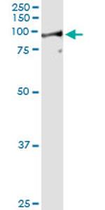 LETM1 Antibody in Immunoprecipitation (IP)