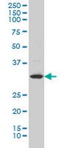 LFNG Monoclonal Antibody (3D12)