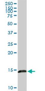 LGALS1 Antibody in Western Blot (WB)