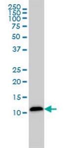 LGALS1 Monoclonal Antibody (1E8-1B2)