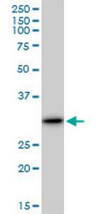 LGALS3 Antibody in Western Blot (WB)