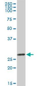 LGALS3 Antibody in Western Blot (WB)