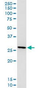 LGALS3 Monoclonal Antibody (3G8)