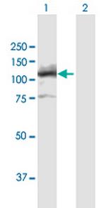 LIG4 Polyclonal Antibody, MaxPab™