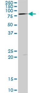 LIMK1 Antibody in Western Blot (WB)