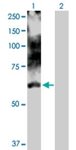 LIMK1 Antibody in Western Blot (WB)