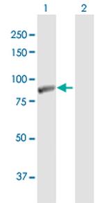 LIMK2 Antibody in Western Blot (WB)