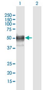 LIPA Polyclonal Antibody, MaxPab™