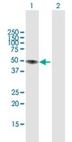 LIPA Polyclonal Antibody, MaxPab™