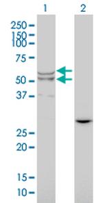 LIPA Monoclonal Antibody (1F9)