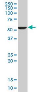 FADS1 Monoclonal Antibody (2D9)