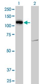 LLGL2 Antibody in Western Blot (WB)