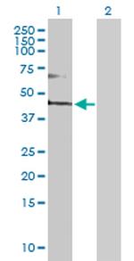 FADS3 Polyclonal Antibody, MaxPab™
