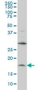 LMO2 Monoclonal Antibody (6B8)