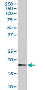 LMO2 Antibody in Western Blot (WB)