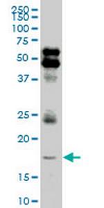 LMO2 Monoclonal Antibody (4D3)