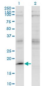LMO2 Monoclonal Antibody (4E2)